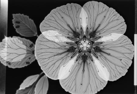 X-Ray - Image 3