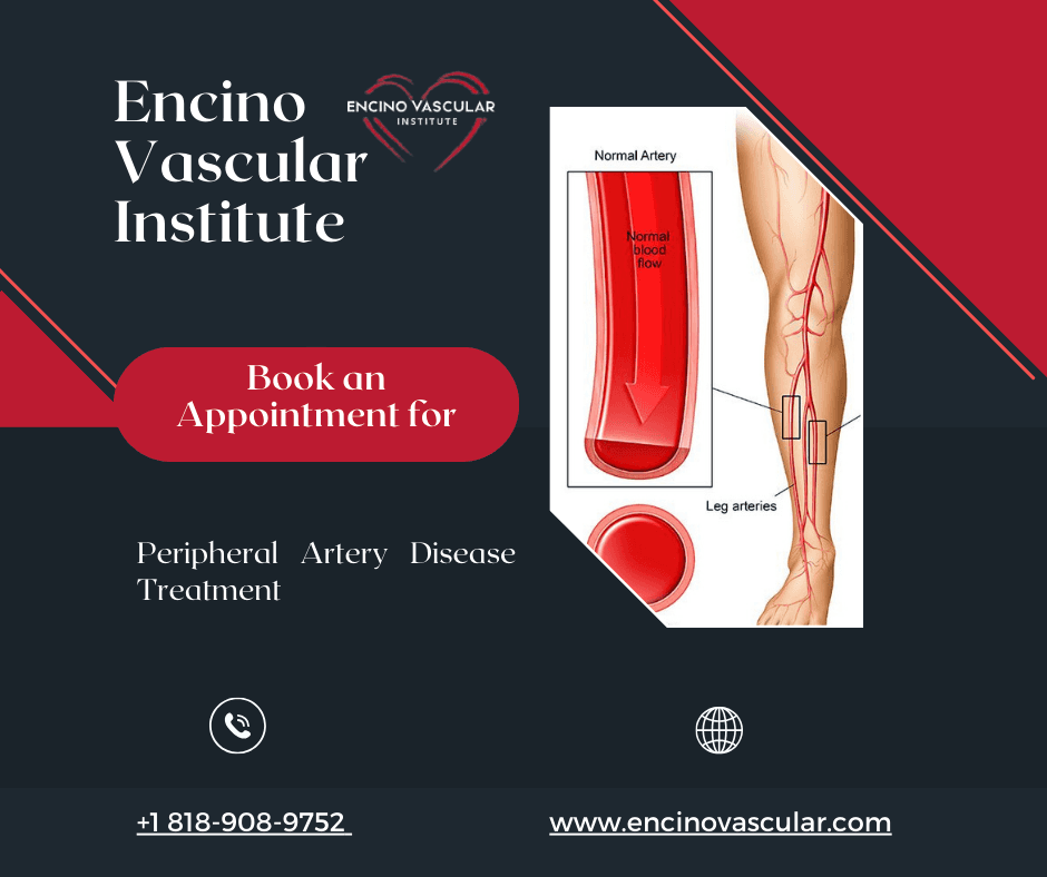 AI generated: Peripheral Vascular