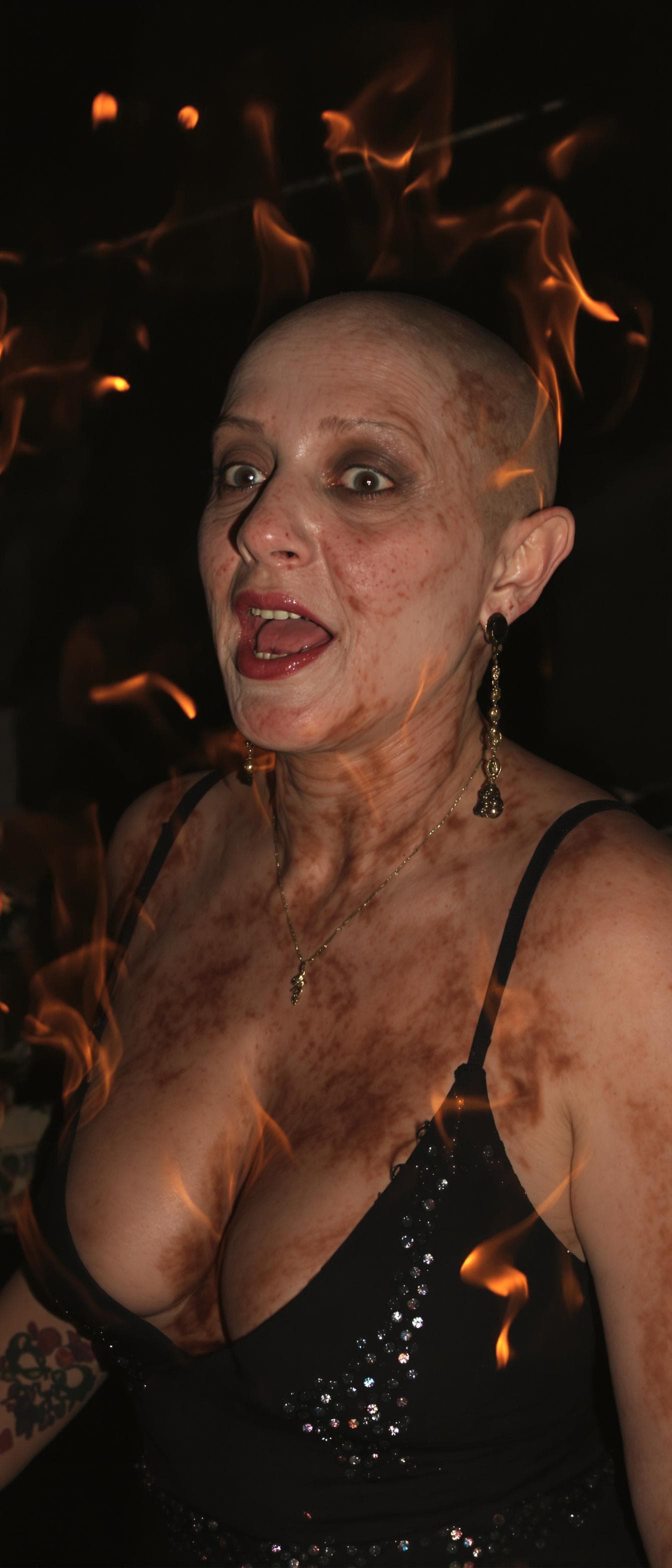 AI generated: An ugly face woman with ugly body  dancing in a party . She is burning in fire . She is bald . She h...
