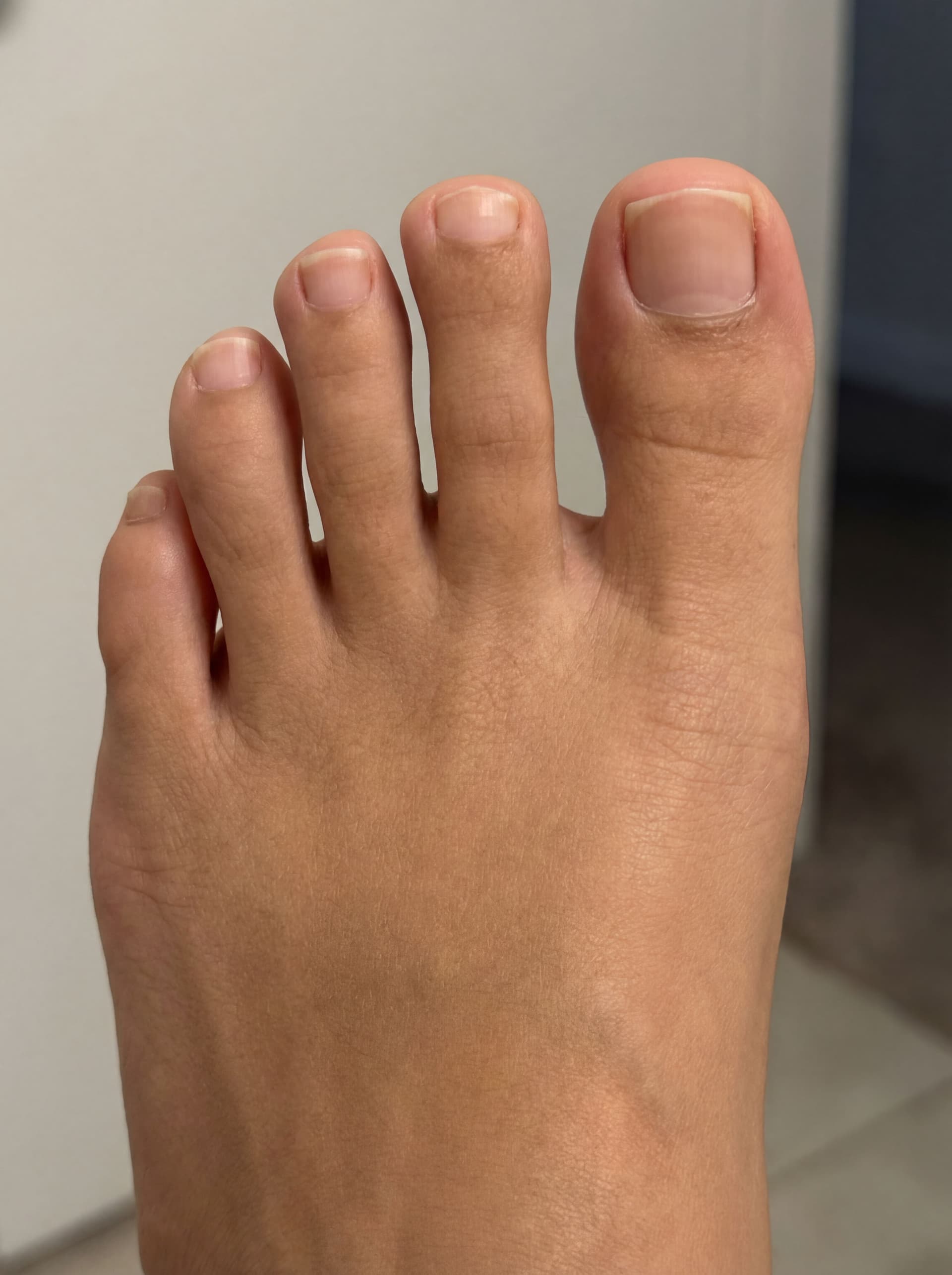 AI generated: {
  "prompt": "Toes are straight and evenly aligned, with the big toe slightly longer than the other...