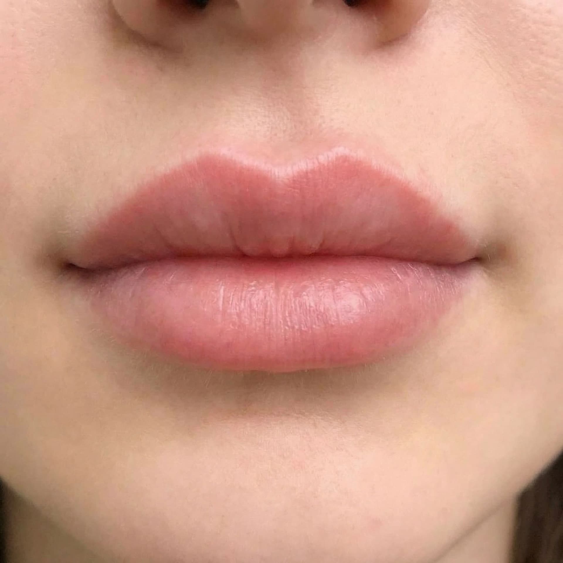 AI generated: Top upper lip. Make it plump, and medium sized. It must be heart-shaped.