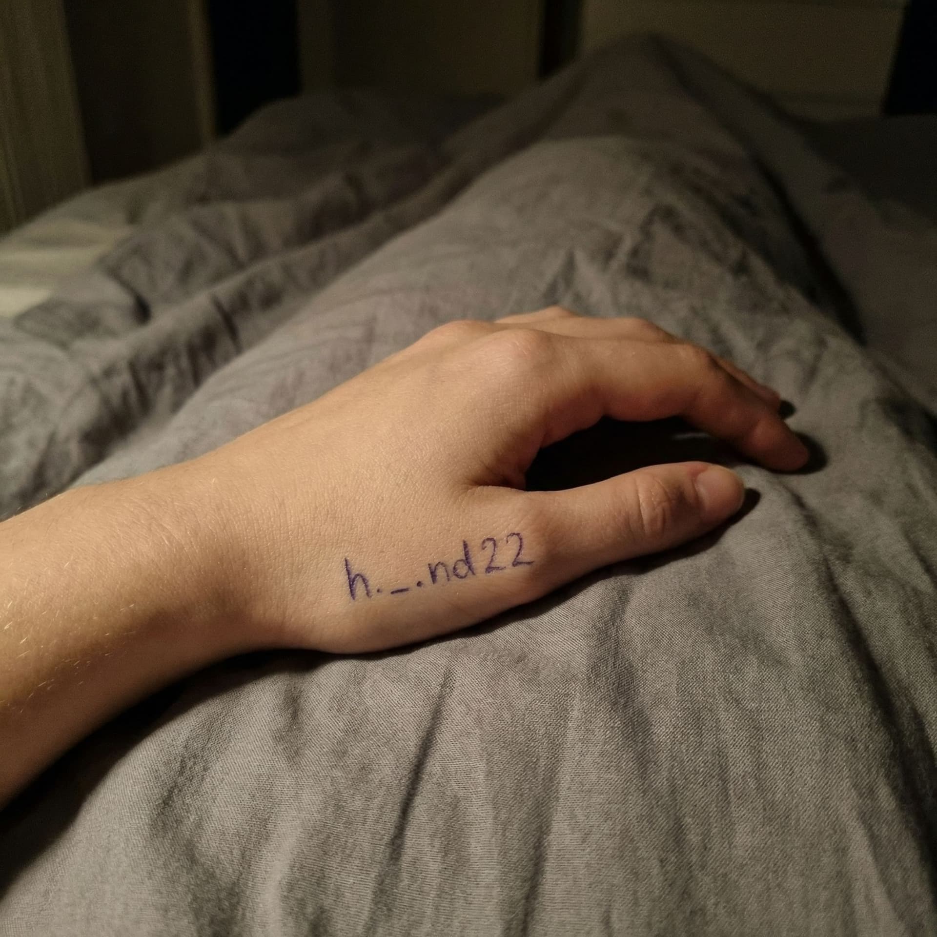 AI generated: A close-up of the hand of a 26-year-old woman with fair skin, resting on a crumpled bedsheet. Only h...