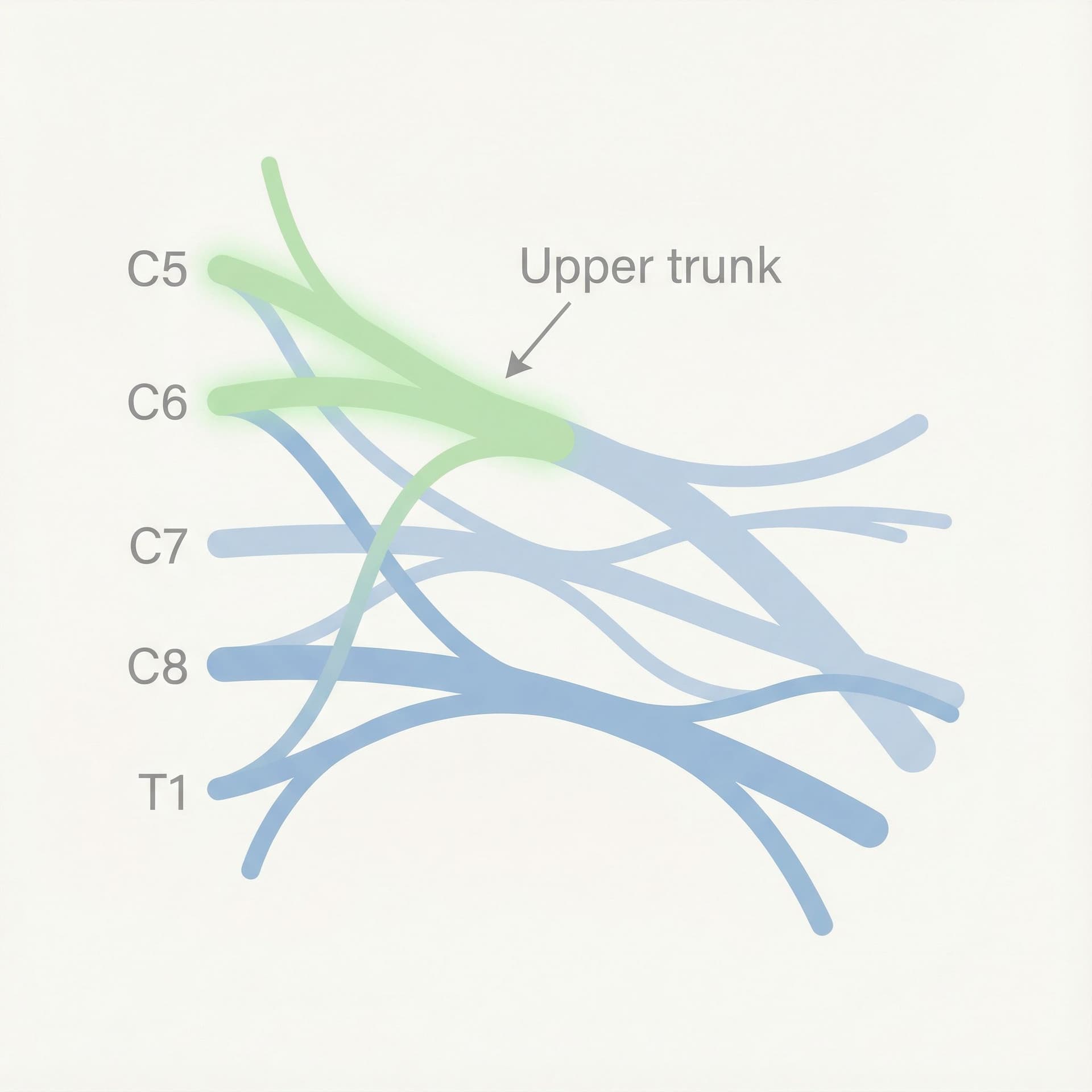 AI generated: Create a medical illustration showing ONLY the brachial plexus nerves.
Display the nerve anatomy fro...