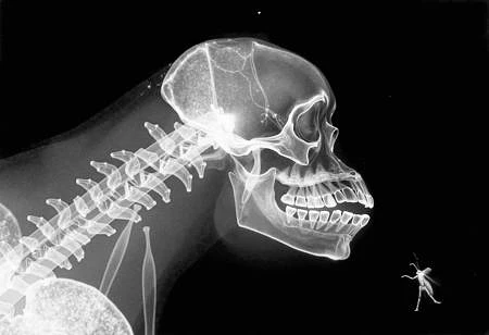 Featured image #5 for X-Ray