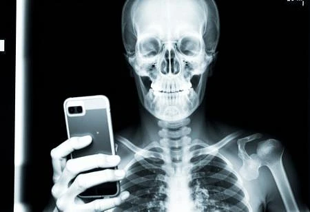Featured image #1 for X-Ray
